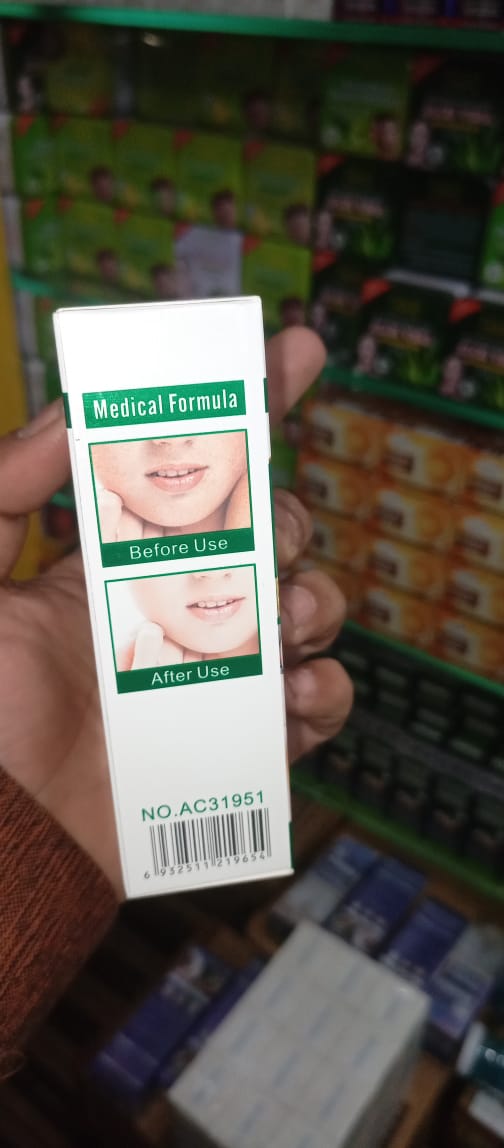Anti-Freckle Whitening Facial Serum �30ml Brightening Formula for Clear, Even-Toned Skin