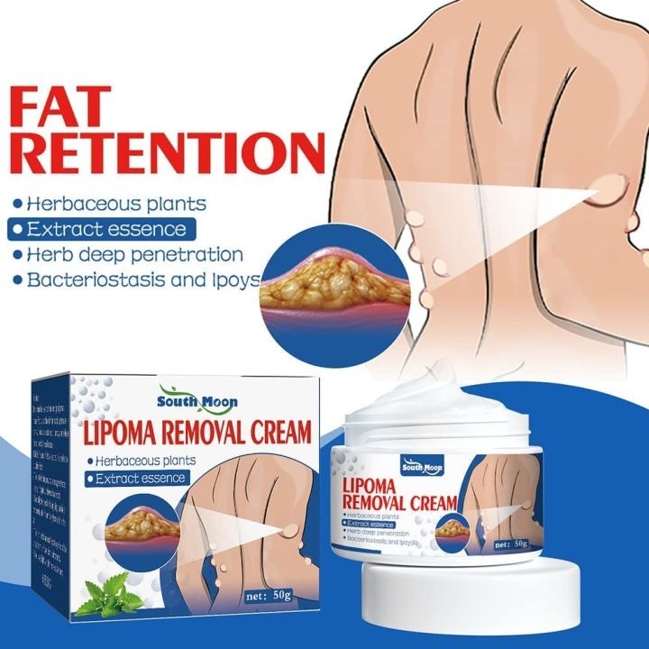 South Moon Lipoma Removal Cream – photo 5