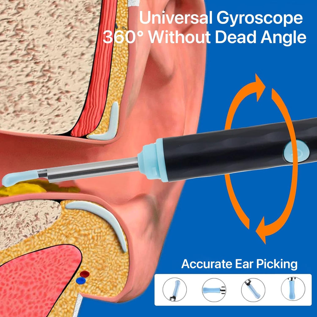 Rechargeable Smart Wireless Ear Camera Kit | Visual Ear Wax Removal Tool With Mobile Display | Random Colour