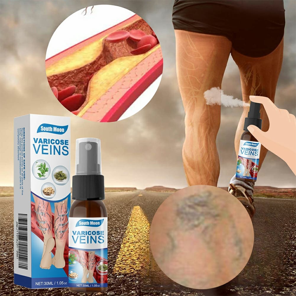 South Moon Varicose Veins Treatment Spray �30ml Advanced Formula for Spider Veins, Leg Pain & Swelling Relief | Natural Herbal Spray for Better Circulation