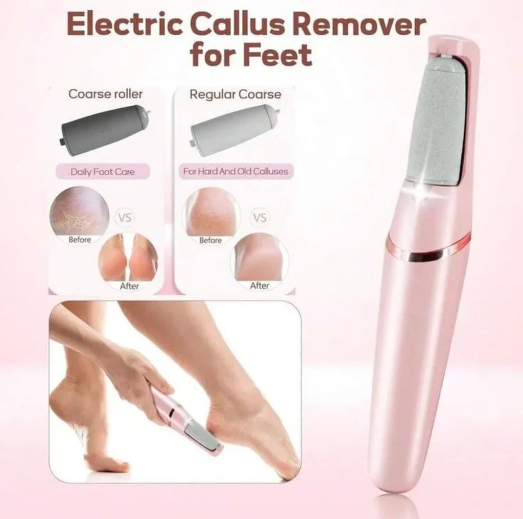 Rechargeable Callus Remover �Portable Foot Care Device for Smooth and Soft Skin