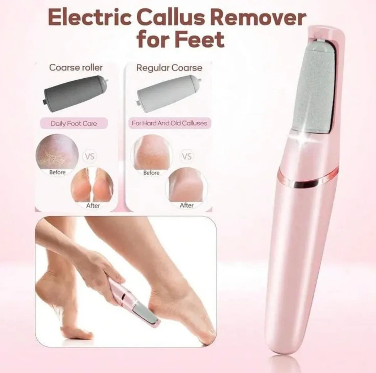 Rechargeable Callus Remover �Portable Foot Care Device for Smooth and Soft Skin