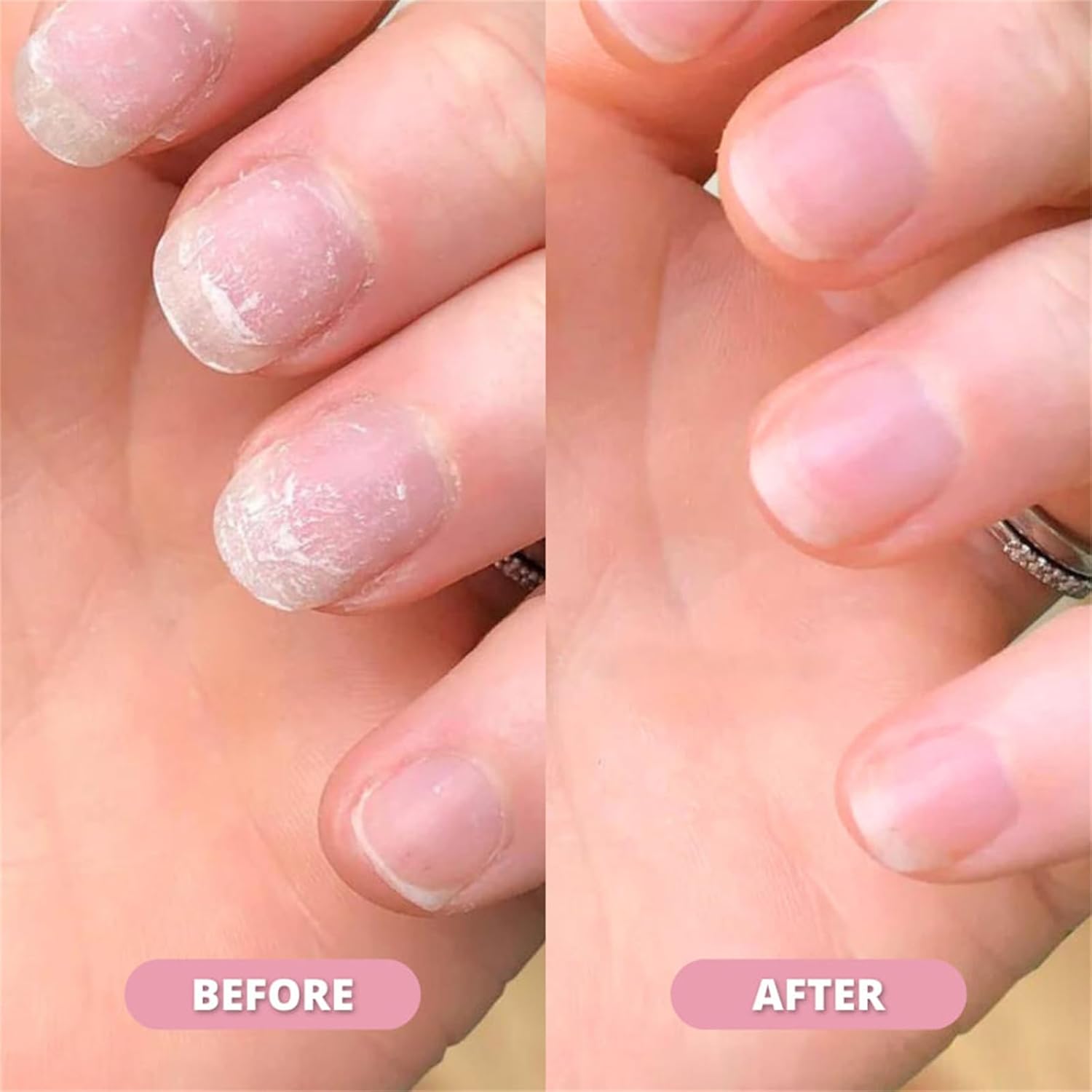 Nail Growth & Cuticle Oil Pen �Radiant Serum Nutrient Pen for Moisturizing, Strengthening & Brightening Nails