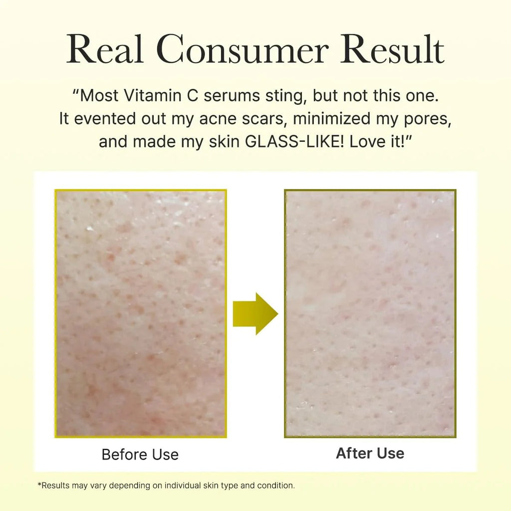 Arencia Vitamin C Booster Shot | Brightening & Skin Radiance Serum (30ml)