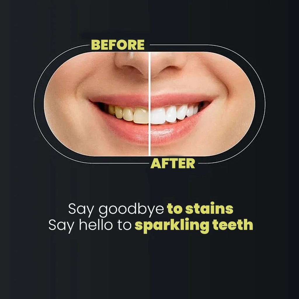 Teeth Whitening Strips 9D Advanced Professional Stain
