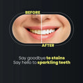 Teeth Whitening Strips 3D Gentle Stain Removing
