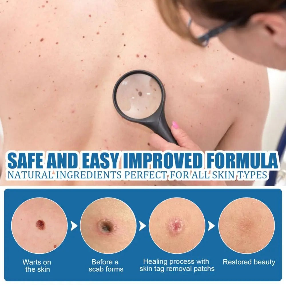 66 Pcs Skin Tag Remover Patch for Face and Body Painless Mole and Wart Removal Treatment