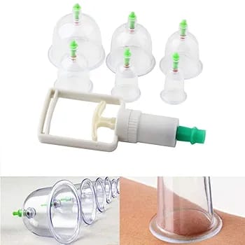 10-Piece Hijama Cupping Therapy Set �Vacuum Suction Massage Cups with Pull-Out Pump | Pain Relief, Blood Circulation, Relaxation & Muscle Recovery Kit