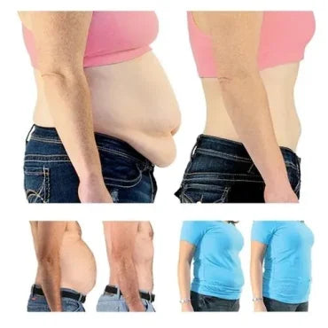 Tummy Tuck Miracle Slimming System Kit – photo 2