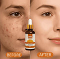 Relax Vitamin C Daily Serum �Brightening & Anti-Aging Face Serum - 30ml