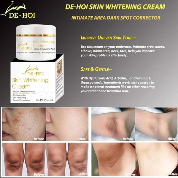 DE HOI Skin Whitening Cream �Brightening &amp; Moisturizing Face and Body Cream for Dark Skin - 75 gram