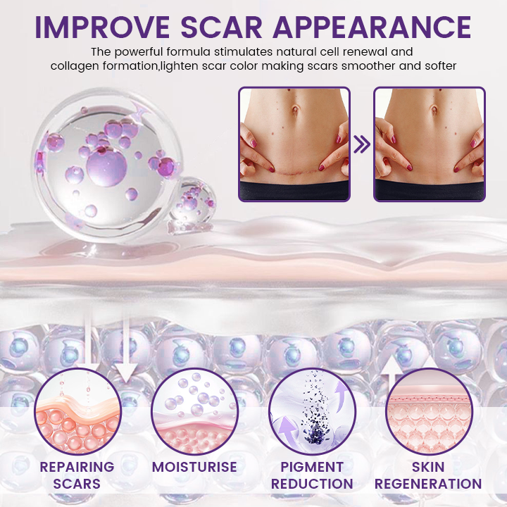 Timilk Regenscar Stem Cell Scar Gel 20g – photo 4