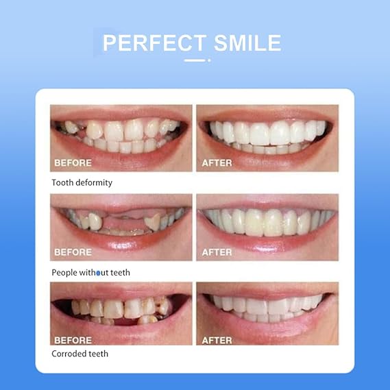 Snap On Smile - Veneers Teeth for Men and Women - Moldable False Artificial Braces Teeth