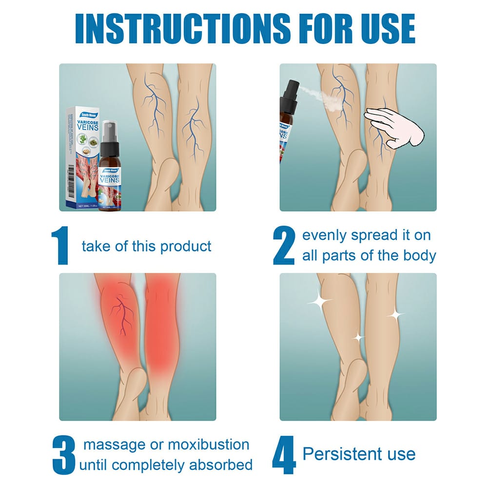 Varicose Veins Treatment Spray �Advanced Formula for Spider Veins, Leg Pain & Swelling Relief ~ 30ml