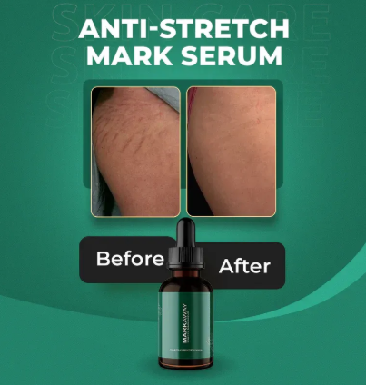 Markaway Stretch Mark Serum �Herbal Formula For Hydration, Toning & Dark Spot Correction (30ml)