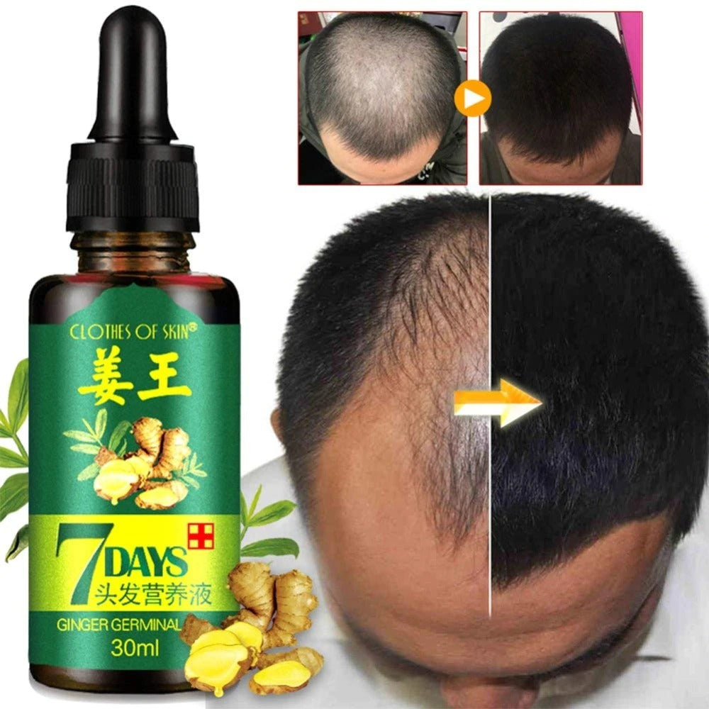 7 Day Ginger Germinal Oil Hair Nutrient – photo 3