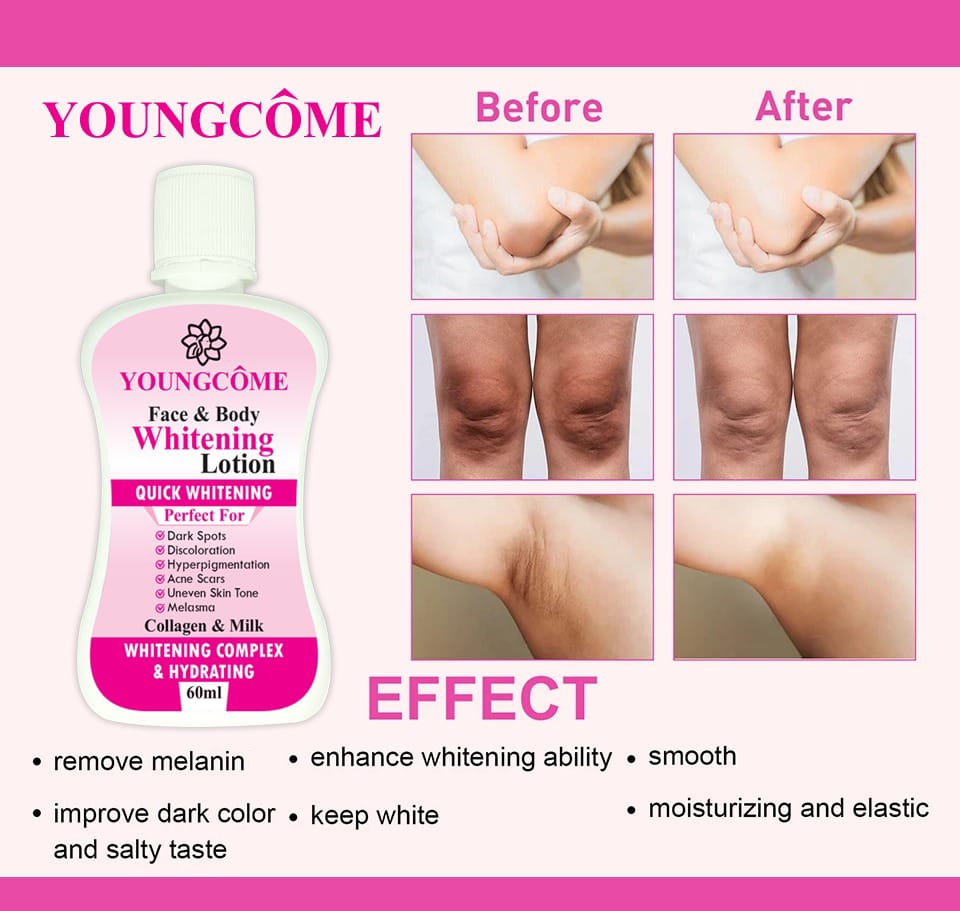 YOUNGCOME 60ml Face Body Whitening Lotion Underarm – photo 1