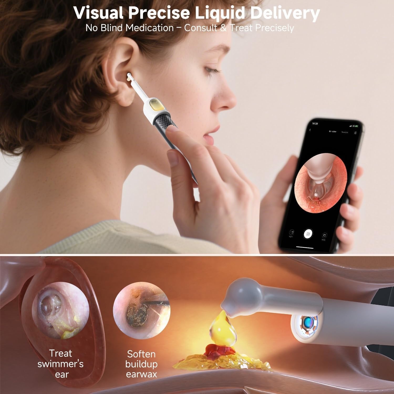 Rechargeable Smart Wireless Ear Camera Kit | Visual Ear Wax Removal Tool With Mobile Display | Random Colour