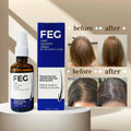 FEG PLUS Hair & Beard Regrowth Spray 50ml �Anti Hair Loss Formula with Minoxidil, Redensyl & Natural Extracts