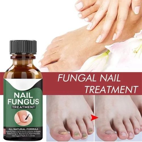 Fast Nail Fungus Treatment Serum �Nail Repair Essence for Finger & Toenail Care (All-Natural Formula)