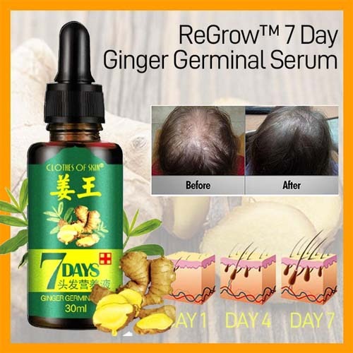 7 Day Ginger Germinal Oil Hair Nutrient – photo 2