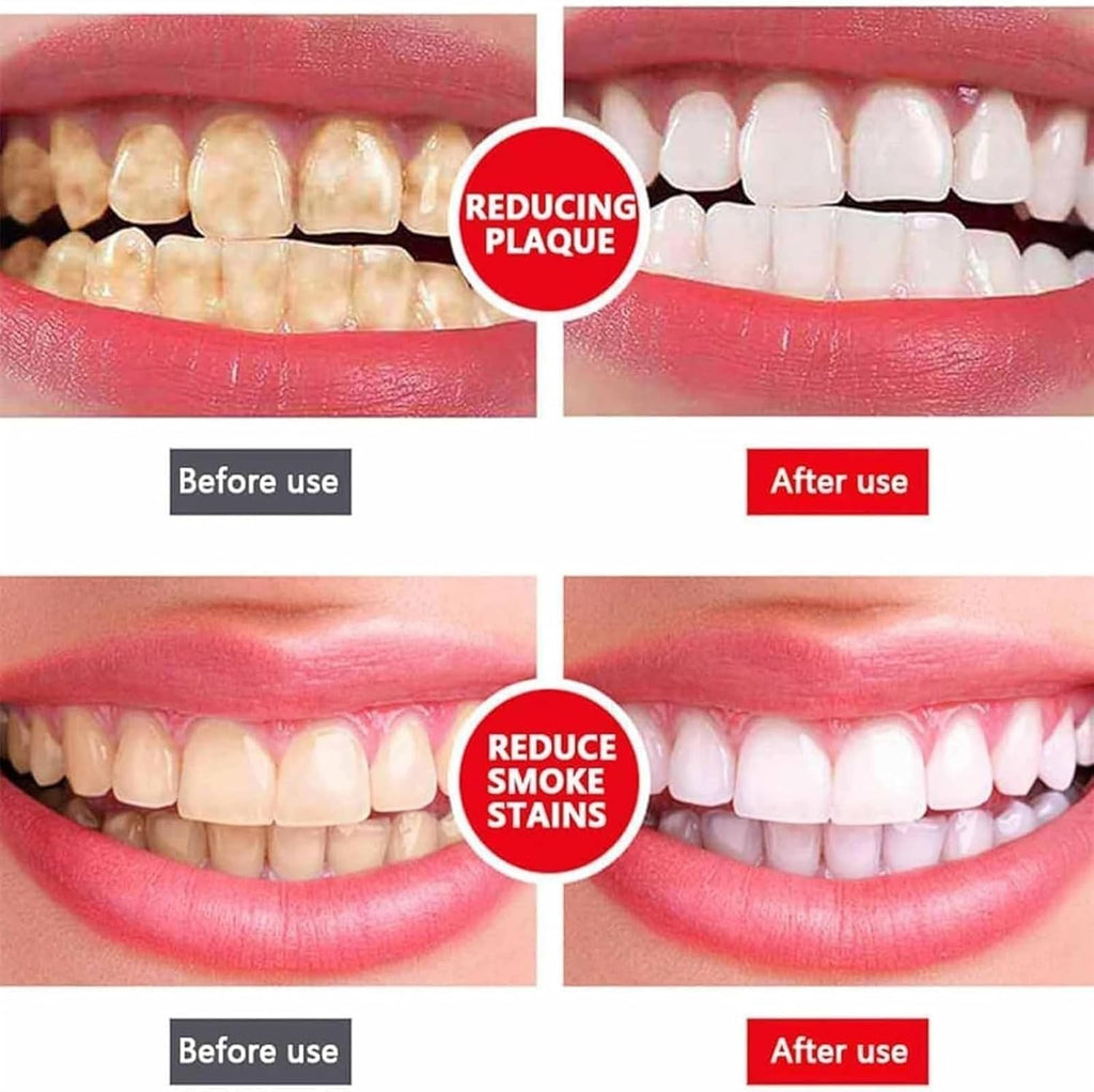 Yayashi Sp-4 Ultra Whitening Toothpaste Probiotic Stain Remover Stain Removing Toothpaste, Protects Gums Freshens Breath, for Everyone