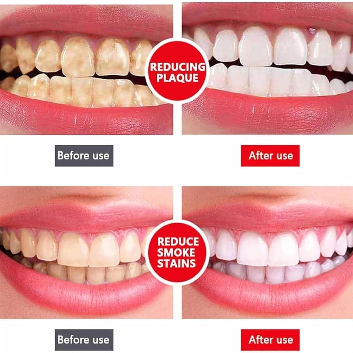 Yayashi Sp-4 Ultra Whitening Toothpaste Probiotic Stain Remover 120Gm / Stain Removing Toothpaste, Protects Gums Freshens Breath, for Everyone