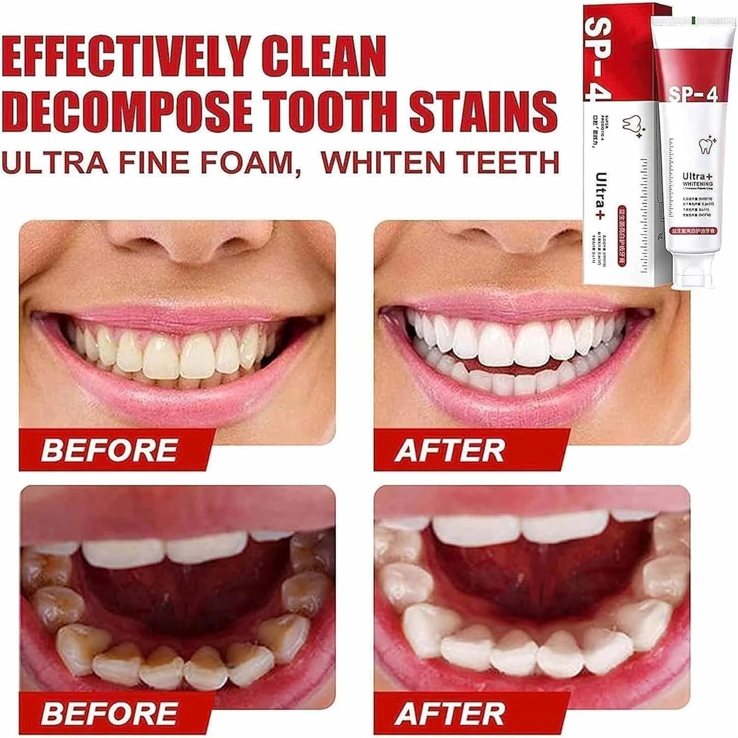 Yayashi Sp-4 Ultra Whitening Toothpaste Probiotic Stain Remover Stain Removing Toothpaste, Protects Gums Freshens Breath, for Everyone