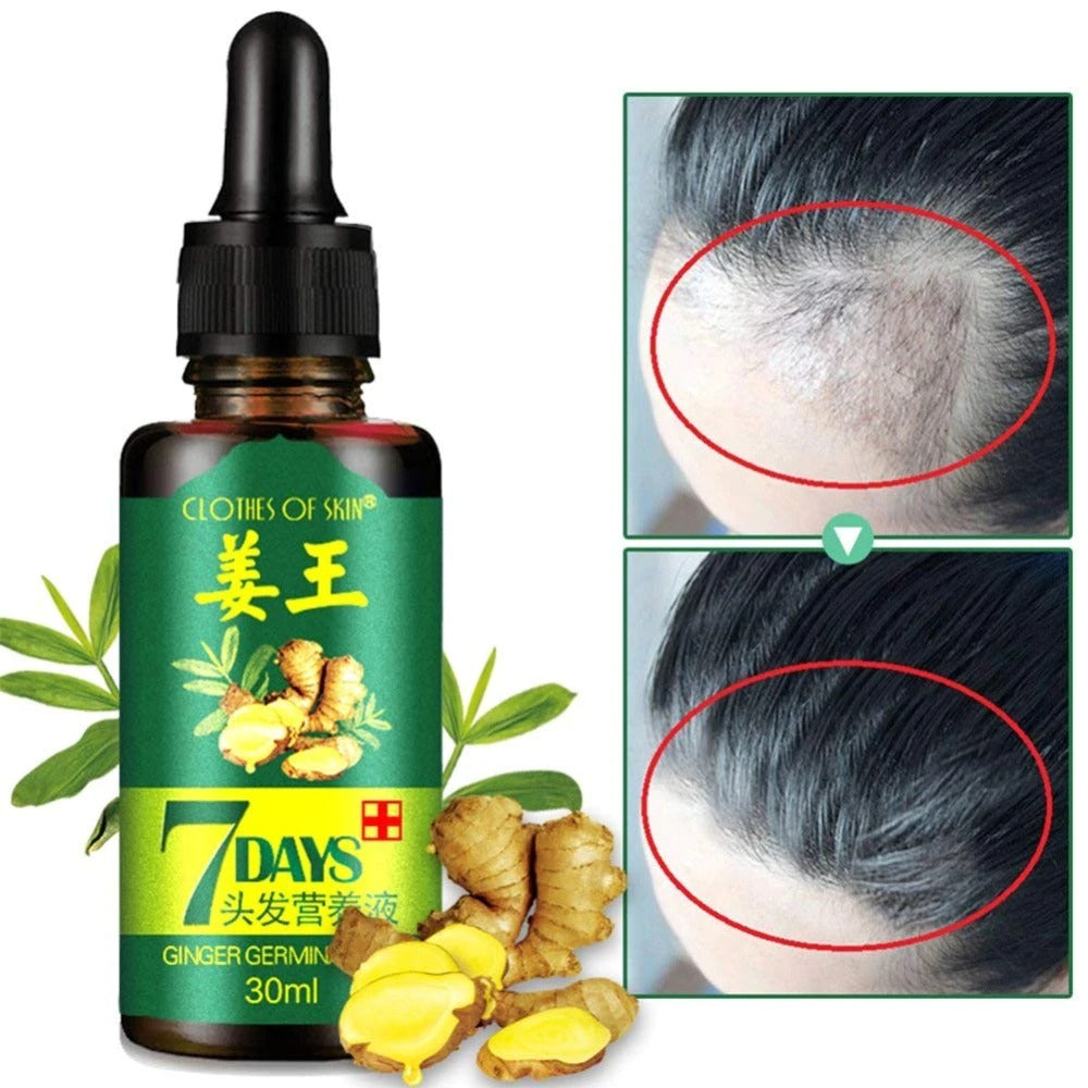 7 Day Ginger Germinal Oil Hair Nutrient – photo 1