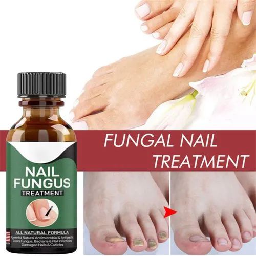 Fast Nail Fungal Treatments Nail Repair Essences – photo 2
