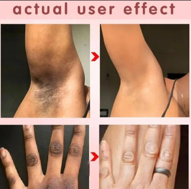 Whitening Cream for sensitive Areas underarm – photo 4