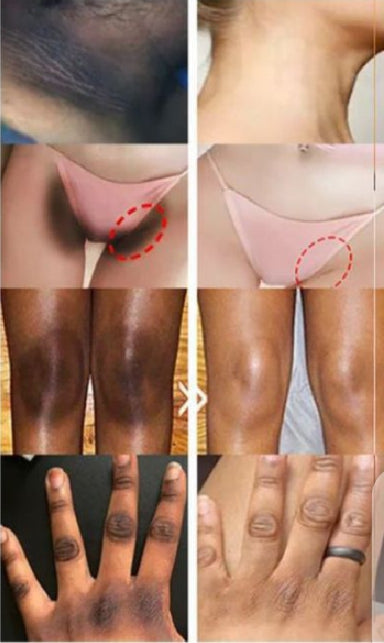 Whitening Cream for sensitive Areas underarm – photo 2