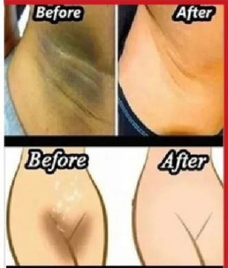 Whitening Cream for sensitive Areas underarm – photo 3