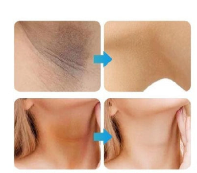 Whitening Cream for sensitive Areas underarm – photo 1