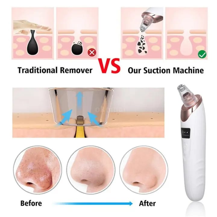 Face Vacuum Blackhead Remover Pore Cleaner | Electric Deep Cleansing Tool for Nose &amp; Face