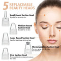 Face Vacuum Suction Blackhead Remover Pore Cleaner – photo 1