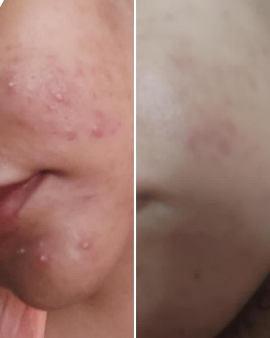 Nirvana Botanics- Vitamin C &amp; E Serum 15ml