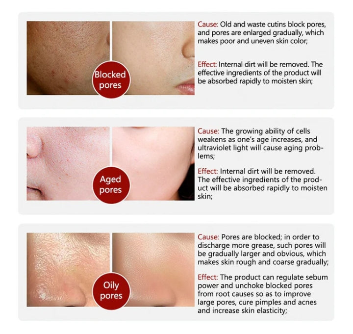Rorec Moisturizing Anti Wrinkle Rice Face Serum for Open Pores 15ml