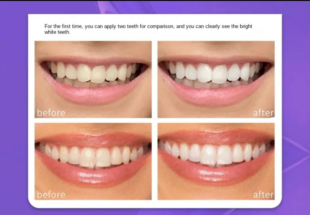 teeth brightening hismiles V34 Colour Corrector Serum – photo 4