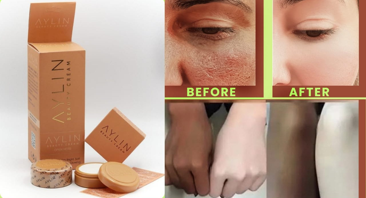 Aylin Beauty Cream Best Cream Ever | Best Quality Cream |? Aylin Beauty Cream For Face Acne Pimples, &amp; Blackheads | Whitening Cream ( Original )