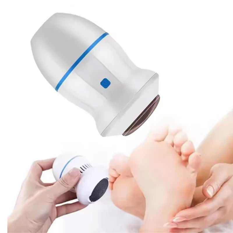 Back Callus Remover with Built-In Vacuum �Electric Foot Grinder for Dead Skin, Cracked Heels &amp; Calluses, Rechargeable Pedicure Tool with Gentle &amp; Powerful Exfoliation