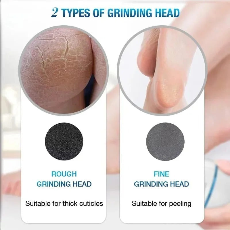 Back Callus Remover with Built-In Vacuum �Electric Foot Grinder for Dead Skin, Cracked Heels &amp; Calluses, Rechargeable Pedicure Tool with Gentle &amp; Powerful Exfoliation