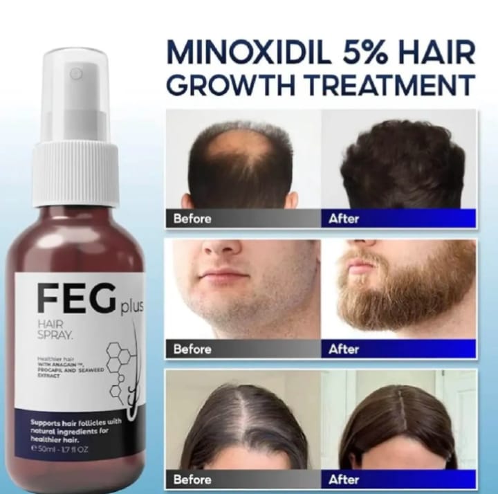 FEG Plus Hair Growth Spray – photo 5