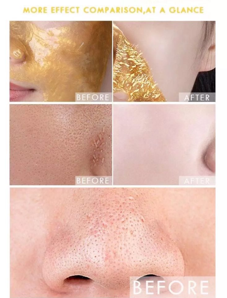 Dr Rashel Original Gold Peel Off Facial Mask �Glow Like Pure Gold �Deep Cleansing &amp; Radiant Glow - 100 ML