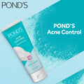 Ponds Anti Acne Solution Face Wash �Gentle Liquid Formula For Clearer Skin Oil Control And Acne Prevention �100 Gram Pack