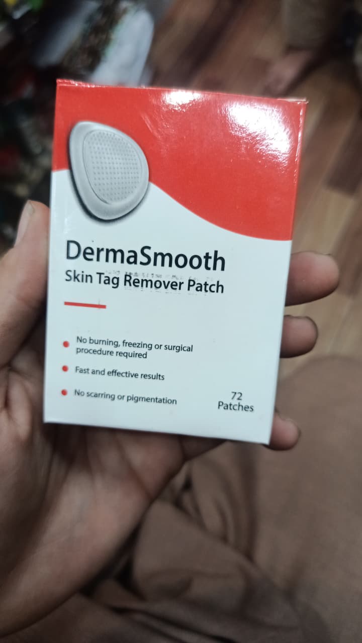 DermaSmooth Skin Tag Remover Patch �Fast, Safe, And Painless Skin Tag And Mole Removal Solution With No Scarring Or Pigmentation