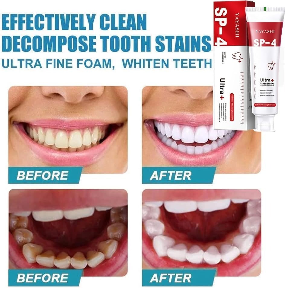 Yayashi SP-4 Ultra Whitening Toothpaste �150ml Probiotic Stain Remover for Bright, Healthy Teeth