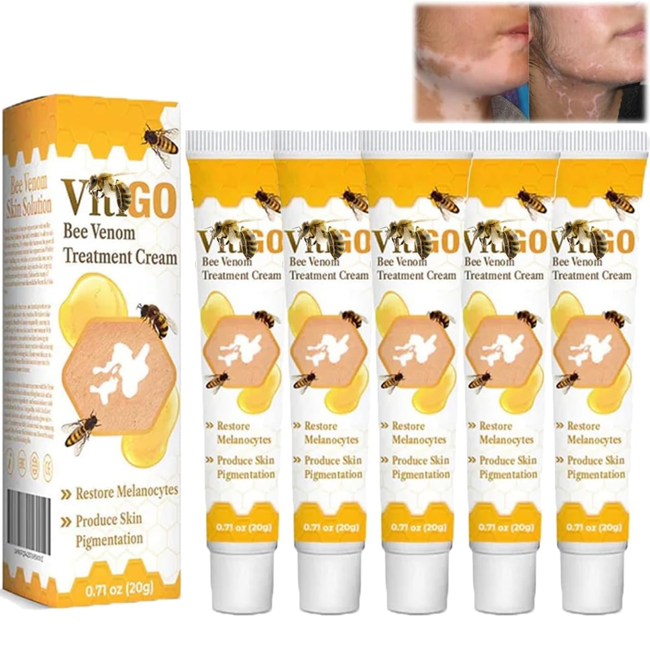 Fivfivgo�VitiGO Bee Venom Correcting Cream (20g) Support for Skin Pigmentation Recovery and Even Skin Tone