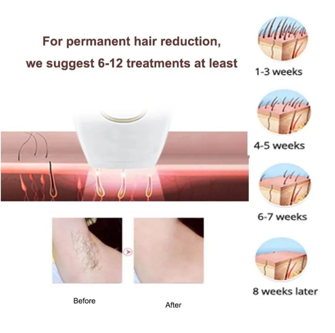 IPL Laser Hair Removal Handset System – photo 4