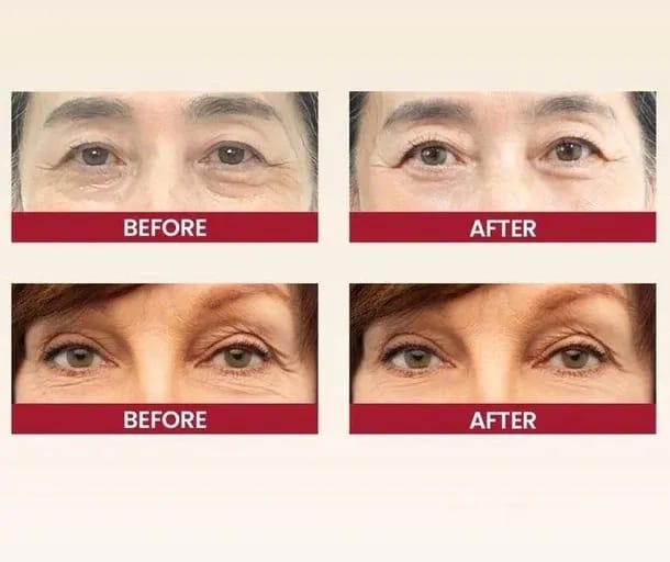 K-SECRET SEOUL 1988 Eye Cream: Retinal Liposome 2% + Fermented Black Bean �Advanced Anti-Aging & Brightening Formula - 30ml